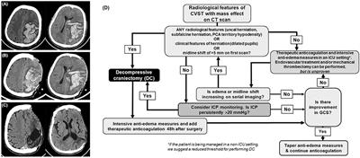 Role of Decompressive Craniectomy in the Management of Cerebral Venous Sinus Thrombosis